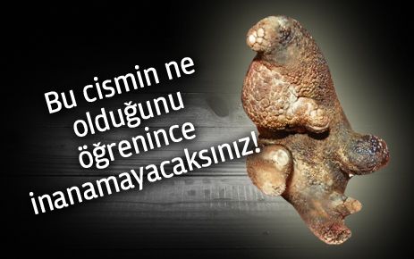 Bu cismin ne olduğunu bileniniz var mı?