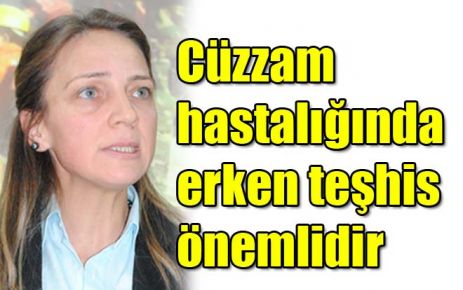 Cüzzam hastalığında erken teşhis önemlidir 