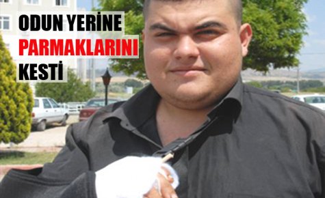 ODUN YERİNE PARMAKLARINI KESTİ 