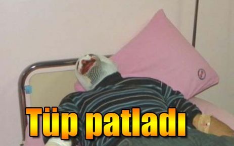 Tüp patladı 
